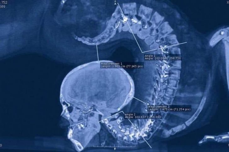 Gymnast doing floor exercises