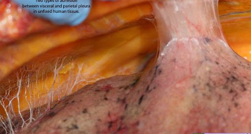 122543835_10221067225303592_5696933359767141885_n