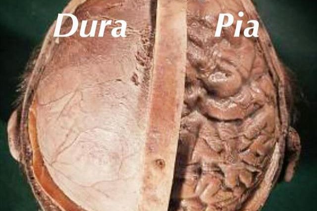 Dura vs Pia